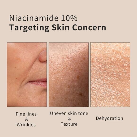 EPIELLE K- Beauty Complex Niacinamide 10% Serum | Matrixyl 3000,‎ Peptide 3.0 oz - Picture 4 of 13